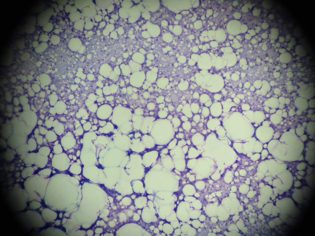 無菌性結節性皮下脂肪織炎の知っておきたい基礎知識 あおきじま動物病院| 長野市